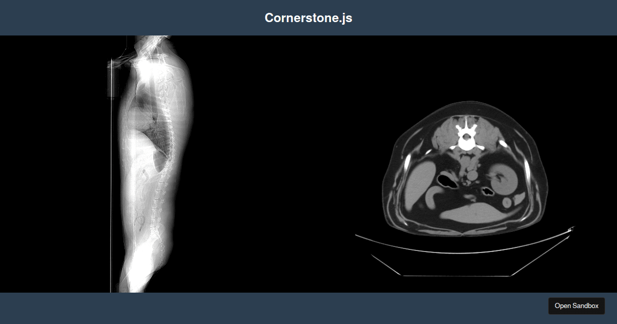 CornerStone Multi-Canvas Example - Codesandbox